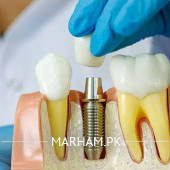 Orthodontist in Faisalabad - Dr. Mahrukh Gull